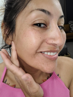 Dayease™ Turmeric & Kojic Acid Soap