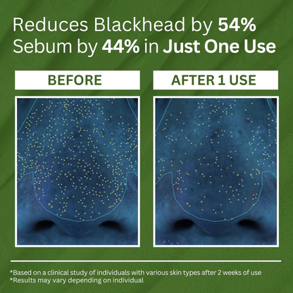 DAYEASE HOLY BASIL MASK - Visibly clearer pores in 3 minutes
